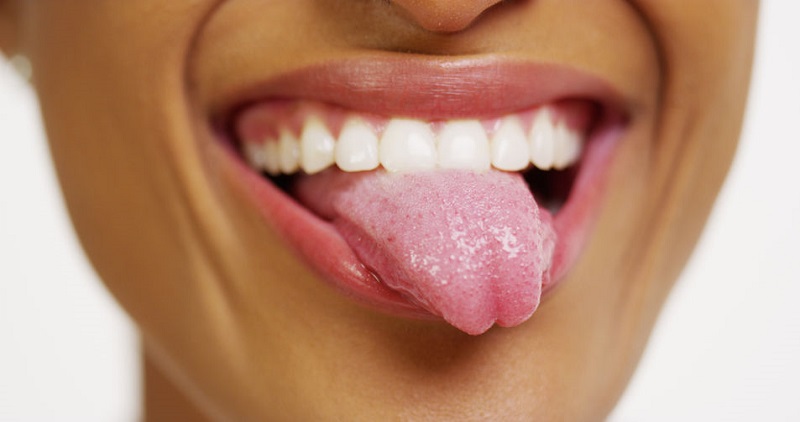dry mouth syndrome